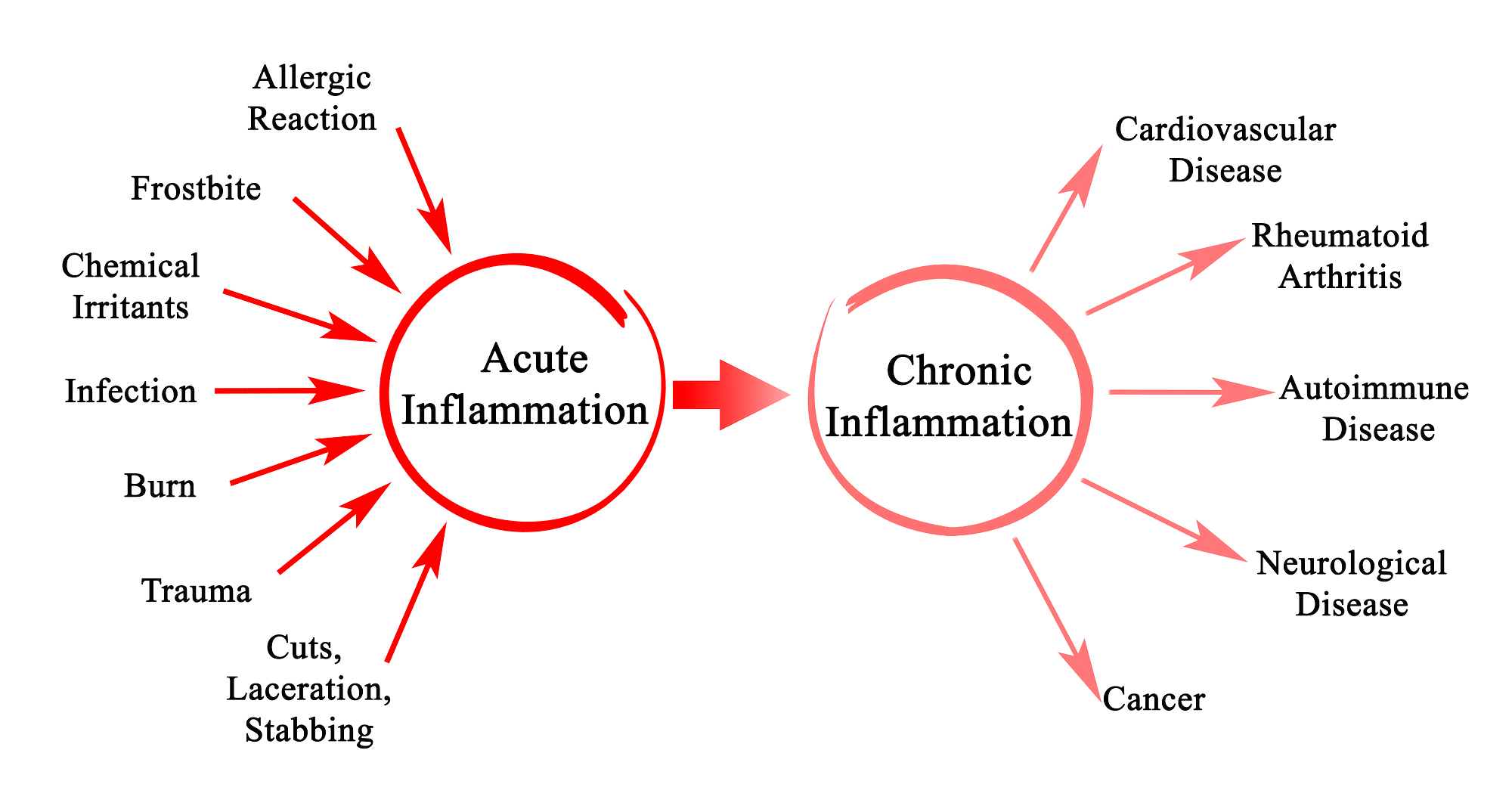 cbd asthma